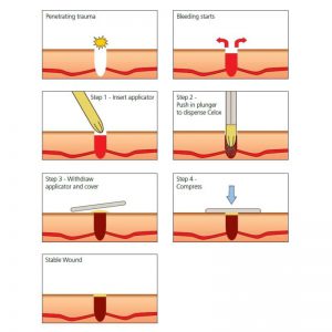 medtrade celox wound trauma respond stop het bloeden bleeding granules dichten levensreddend